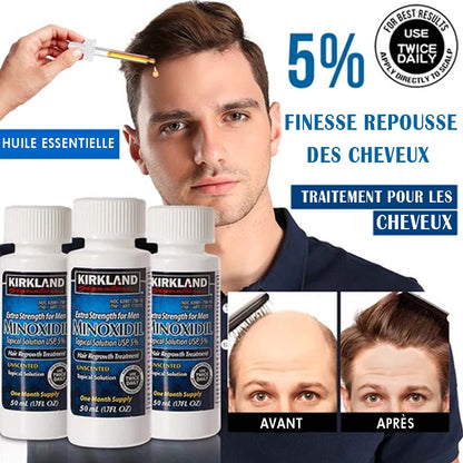 Minoxidil 5% Traitement Extra Fort Pour La Repousse Des Cheveux