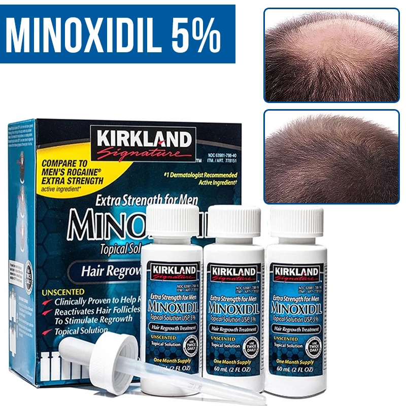 Minoxidil 5% Traitement Extra Fort Pour La Repousse Des Cheveux